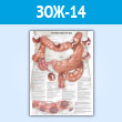Плакат «Колоректальный рак» (ЗОЖ-14, пластик 2 мм, A1, 1 лист)